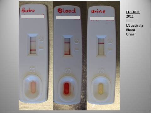 Healthcare workers can be quickly trained to apply blood or lymph node aspirate to the dipstick, which yields results in 15 minutes. The dipsticks do not require electricity or refrigeration&mdash; important in an environment where electricity is sporadic. Photo Credit: NCEZID